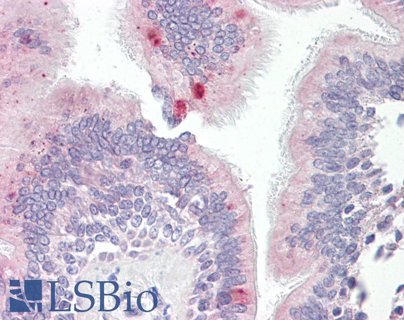 IHC-plus™ Polyclonal Rabbit anti-Human AP3M1 Antibody (aa140-190, IHC, WB)