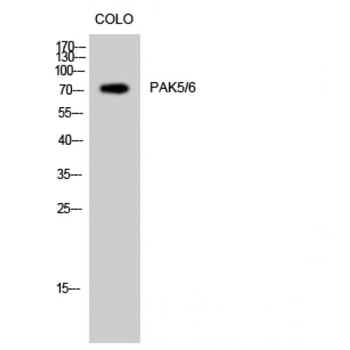 PAK5 + PAK6 Antibody (540-620 aa)