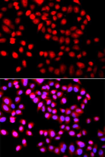 SETD6 Antibody