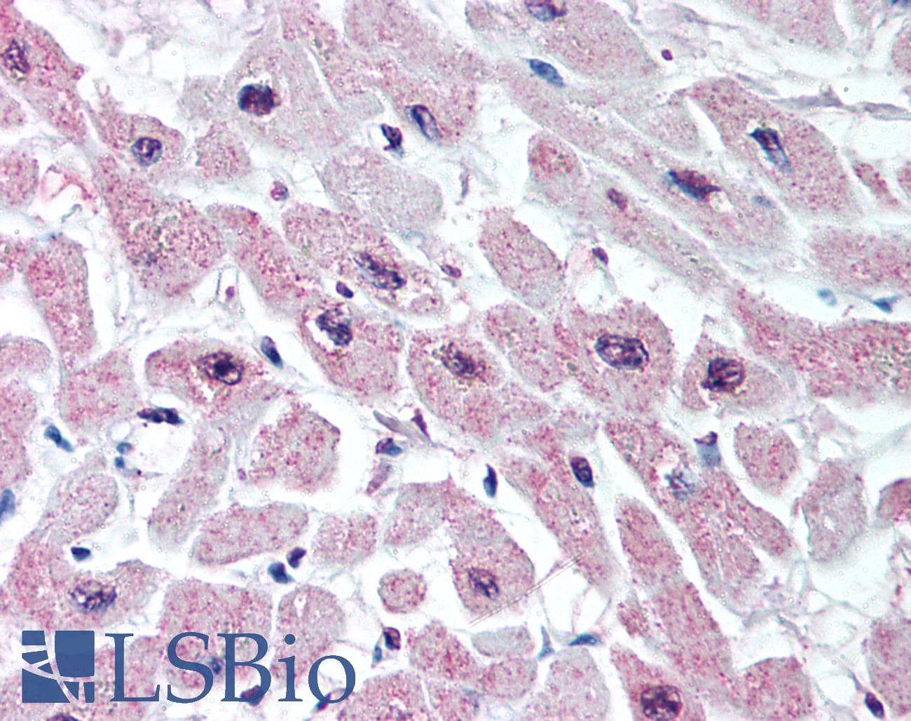 IHC-plus™ KCNJ3 / GIRK1 Antibody (Internal)