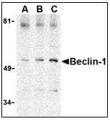 Polyclonal Rabbit anti-Human BECN1 / Beclin-1 Antibody (IHC, IF, WB)