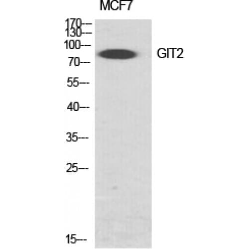 GIT2 Antibody (330-410 aa, Internal)