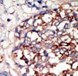 DYRK1B Antibody (aa561-589)