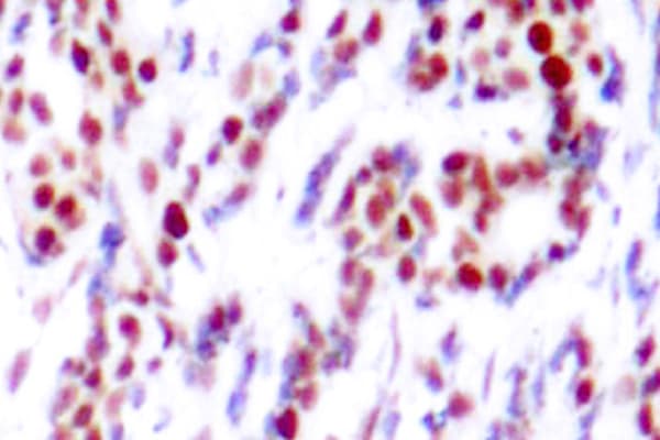 ATF2 Antibody (phospho-Thr71)
