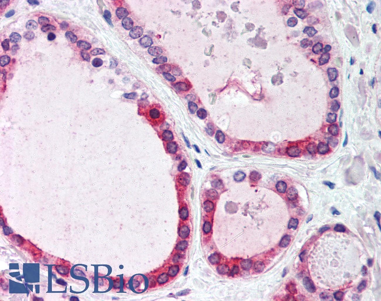 IHC-plus™ Polyclonal Rabbit anti-Human WNT4 Antibody (Internal, IHC)