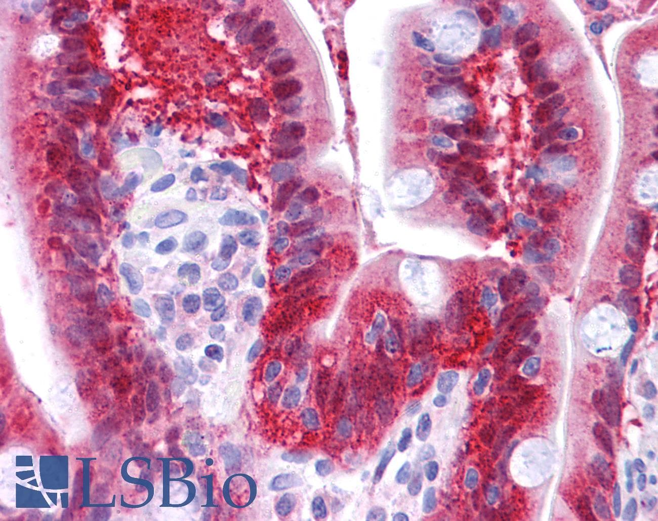 Polyclonal Rabbit anti-Human NME1 / NM23 Antibody (N-Terminus, IHC, WB)