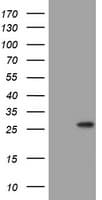 BNIP1 Antibody (aa1-199, clone OTI3G1)