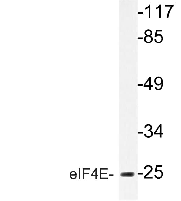 EIF4E Antibody (Thr203)