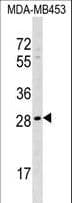 AIDA Antibody (aa255-283)