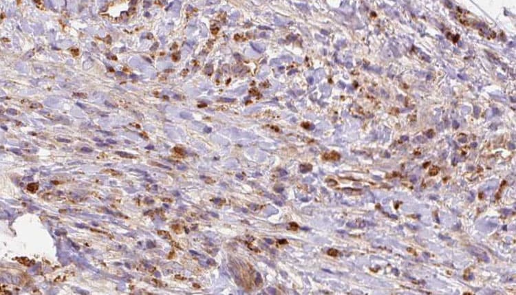 GRM2 / MGLUR2 Antibody