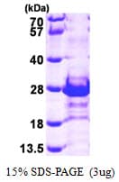 Human CACYBP Protein (Recombinant His)