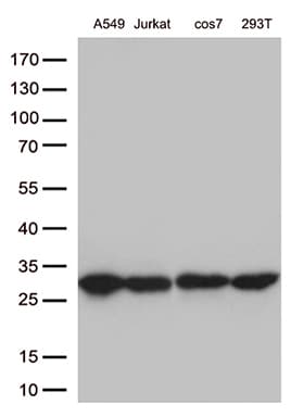BCL2 / Bcl-2 Antibody (clone UMAB225)