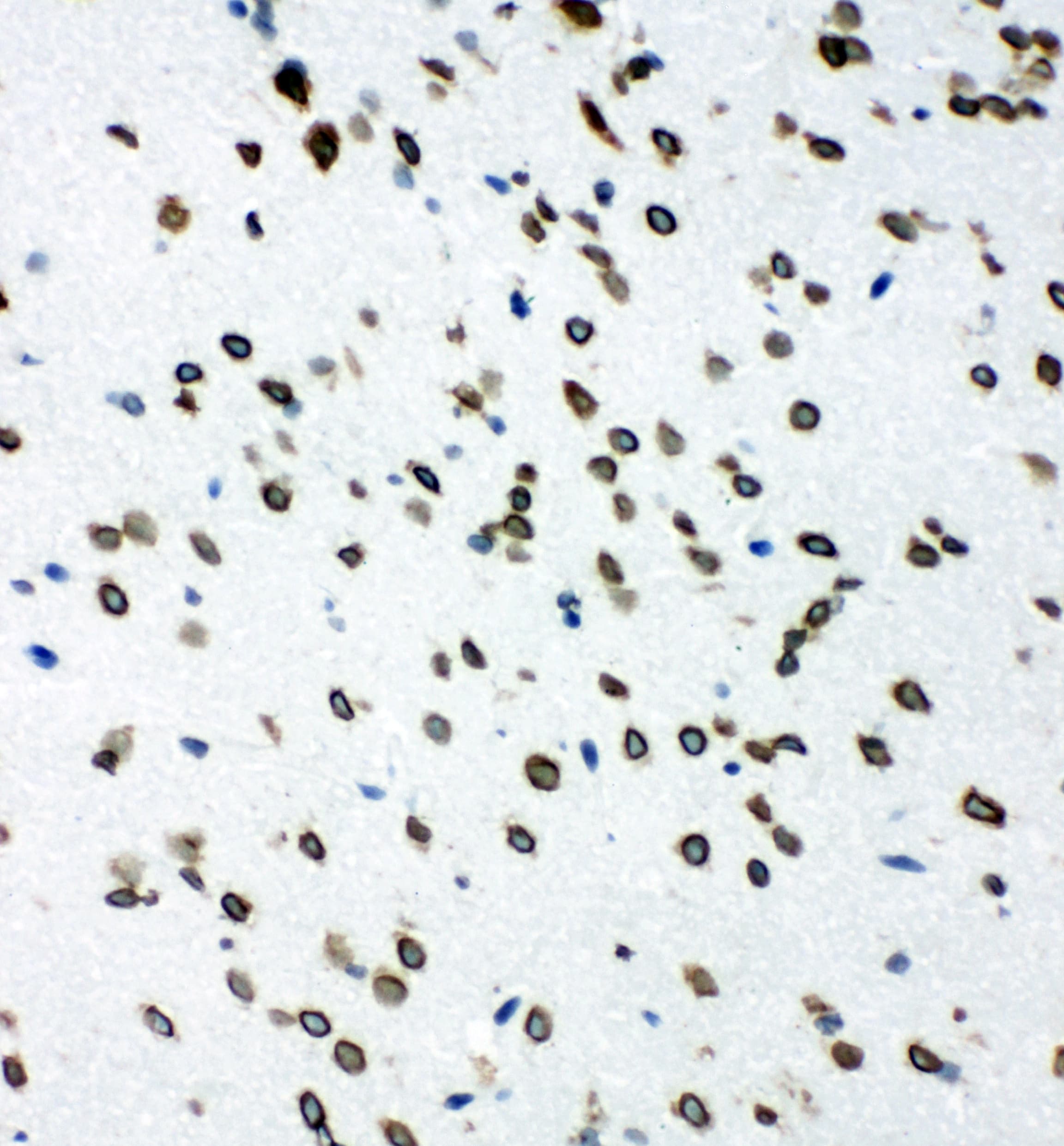 Polyclonal Rabbit anti-Human p66 / SHC Antibody (aa424-440, IHC, WB)