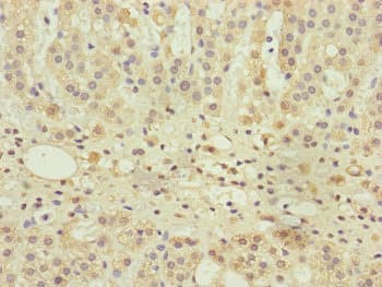 Polyclonal Rabbit anti-Human UXT Antibody (IHC)