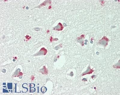 IHC-plus™ Polyclonal Rabbit anti-Human E4 / UBE4A Antibody (N-Terminus, IHC, WB)
