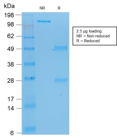 PathPlus™ TP53 / p53 Antibody (clone rBP53-12)