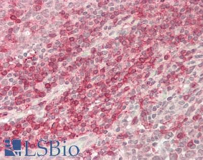 IHC-plus™ Polyclonal Rabbit anti-Human CD3E Antibody (aa 23-207, IHC, WB)