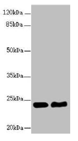 IHC-plus™ RAB5B Antibody