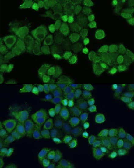SMAD2 Antibody