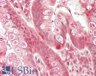 IHC-plus™ GLYCTK / Glycerate Kinase Antibody (aa144-523)