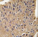 ANTXR1 / TEM8 Antibody (Tyr382)