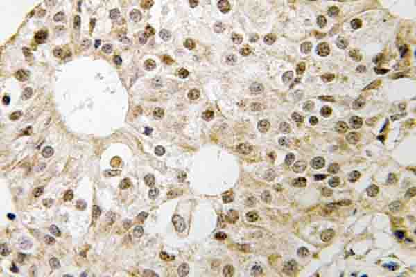 CD3EAP Antibody (Glu474)