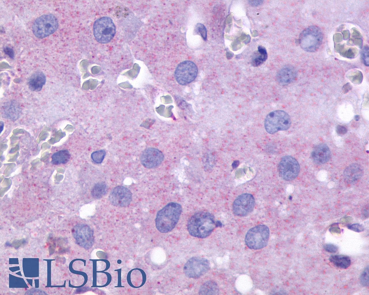IHC-plus™ FP / PTGFR Antibody (Cytoplasmic Domain)