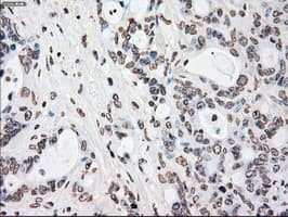 PLK1 / PLK-1 Antibody (clone OTI5C1)