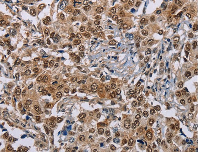 GTF2I / TFII I Antibody
