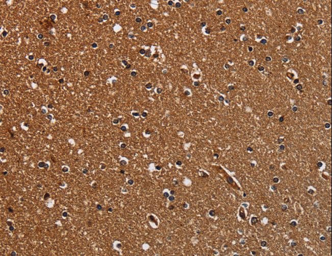 TICAM2 / TRAM Antibody