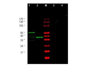CHEK1 / CHK1 Antibody