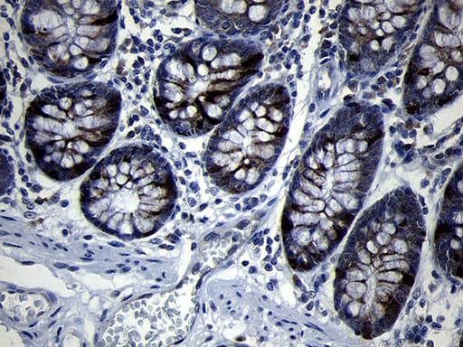 Monoclonal Mouse anti-Human RRM2 Antibody (clone OTI1F2, IHC, WB)