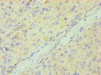 Polyclonal Rabbit anti-Human CD33 Antibody (aa49-259, IHC)