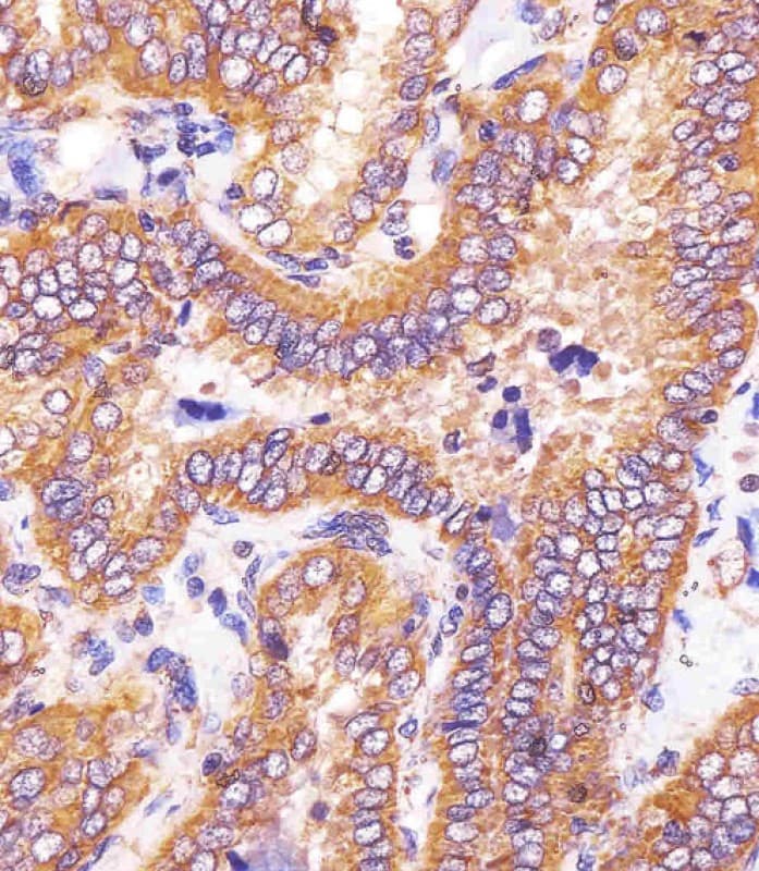 Polyclonal Rabbit anti-Human HSD17B10 / HADH2 Antibody (Internal, IHC, IF, WB)