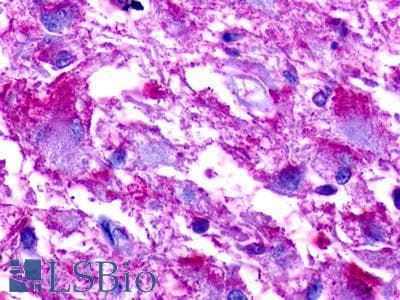 PathPlus™ TAAR2 / GPR58 Antibody (C-Terminus)