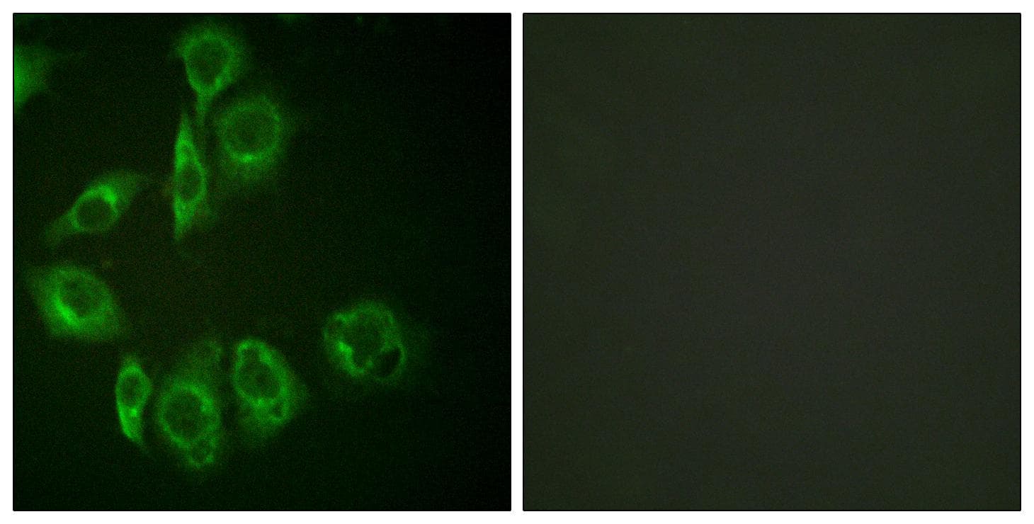 PKC / Protein Kinase C Antibody (phospho-Thr497)
