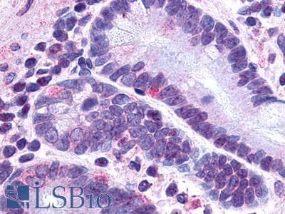 PathPlus™ GLP2R Antibody (N-Terminus)