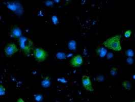 SLC7A8 / LAT2 Antibody (clone 4A6, Carrier-free)