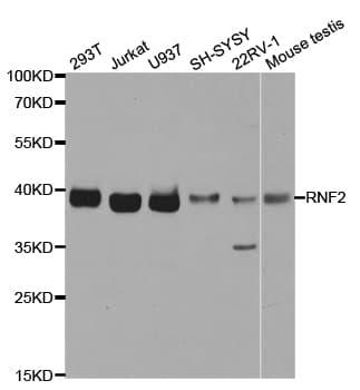 RNF2 / RING2 / RING1B Antibody