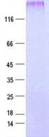 Human PPIP5K2 / HISPPD1 Protein (Recombinant His, N-Terminal)