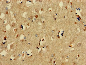 Polyclonal Rabbit anti-Human SNCAIP / Synphilin 1 Antibody (IHC, IF)