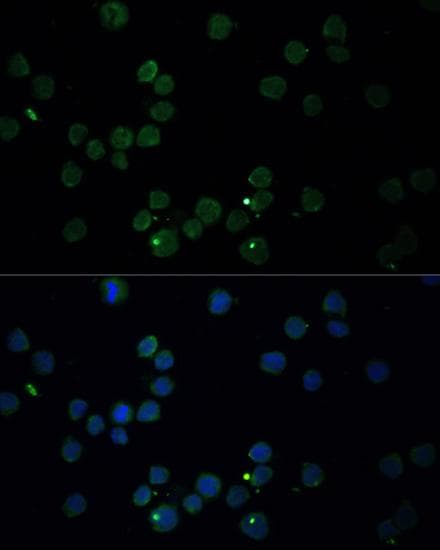 CHAT Antibody