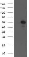 CCM2 / Malcavernin Antibody (clone OTI1B9, Carrier-free)