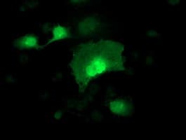 ADH2 / ADH1B Antibody (clone OTI4F12)