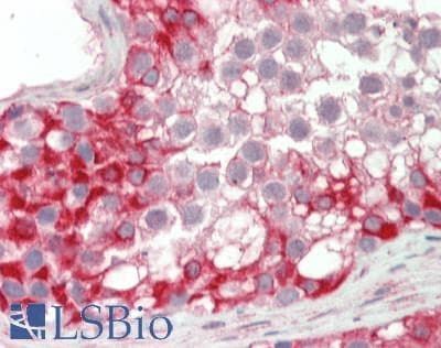 KLHL25 Antibody (aa144-193)