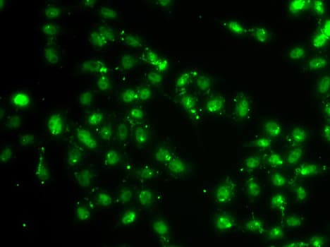L3MBTL1 Antibody