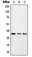 ZC3H8 Antibody (Internal)
