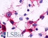 PathPlus™ GPR44 / CRTH2 Antibody (N-Terminus)