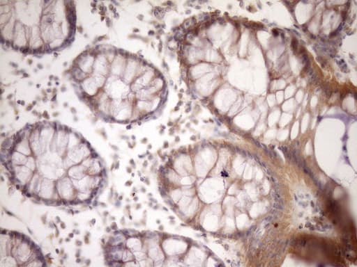 MST1 Antibody (aa194-462, clone OTI1A10, Carrier-free)