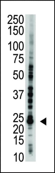 UBE2S / E2 EPF Antibody (aa192-222)